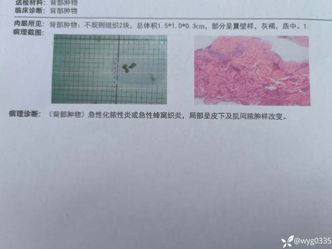 揭西县：粤东山区屏障下的低感染样本