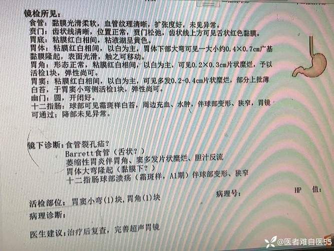 2022年8月12日巩留新增确诊病例情况_82206