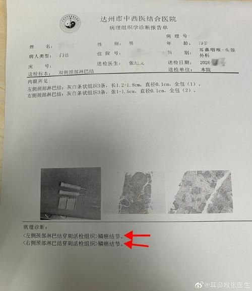 2022年1月5日河南西峡新增确诊病例情况