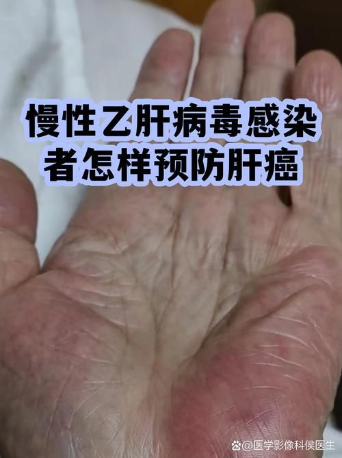 波密：雪域林海间的零感染防线如何筑成？