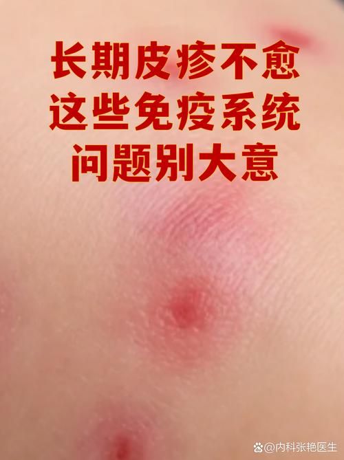 图木舒克市新增1例无症状感染者  图木舒克市疫情防控最新通报_53913
