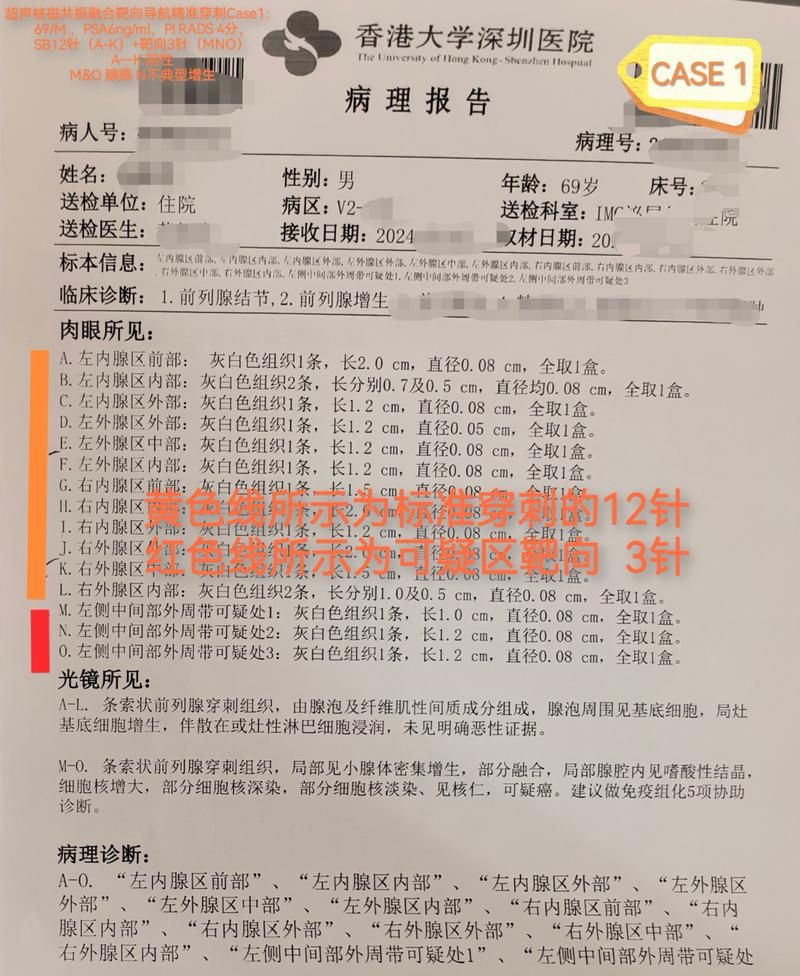 2022年3月27日寿光新增确诊病例情况