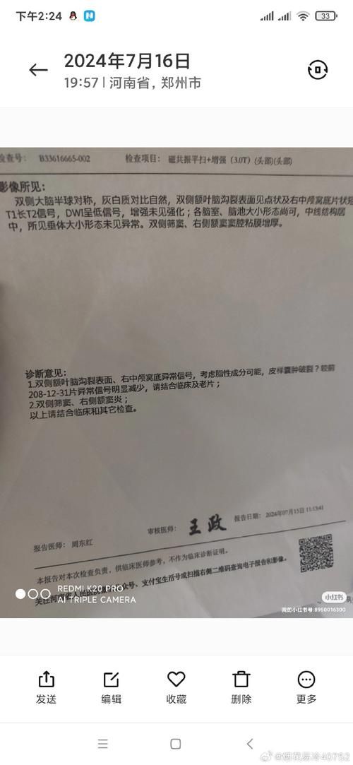 本地确诊+5，平房区通报新增病例情况_22965