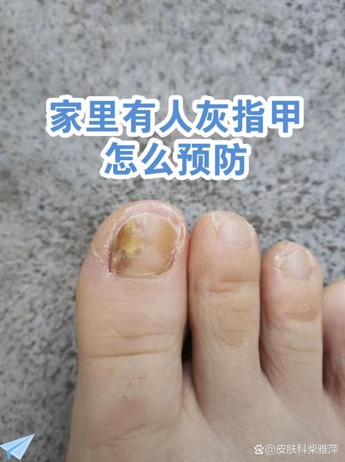 锦江区的防疫挑战：城市核心区如何阻断传播链？