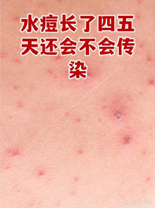 元江哈尼族彝族傣族自治县新增1例无症状感染者  元江哈尼族彝族傣族自治县疫情防控最新通报